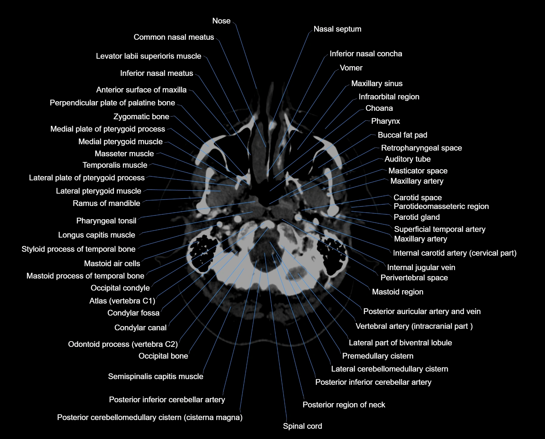 CT scan brain axial labelled cross sectional anatomy image-img-00003.webp
